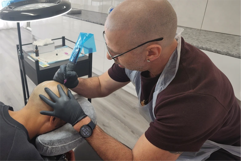 hair-restoration-hair-loss-tattoo